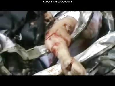 Man left Unrecognizable in a Pile of Twisted Metal is a MESS