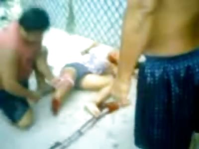 Young Girl with Severed Foot in a World of Pain after Accident (Cell Phone Quality)