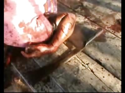 A Man's Messy Suicide in Secluded Park