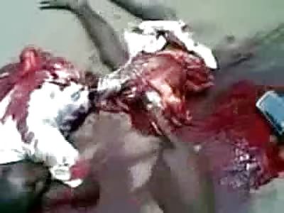 Comfortable looking Boy Ripped in Half and still Wide Awake