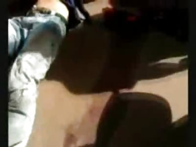 Boy with Fully Severed Arm Falls on his Face in the Street