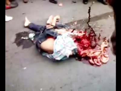 Boy Run over has his Brains and Guts pushed out his Neck Area