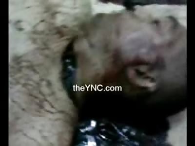 Naked Man Suicide by Slit Throat has Large Knife on top of his Chest