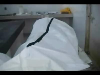 Young Girl Strangled Creepy Morgue Footage