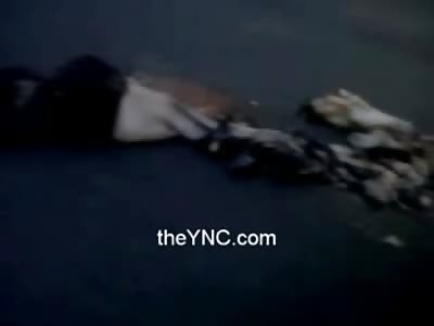 Man in Shock carries his Friends Guts down the Road to his Mangled Ripped apart Body in hopes it will Help Somehow