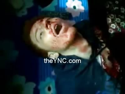 Two Brothers Chest Blown Open in their Bedroom