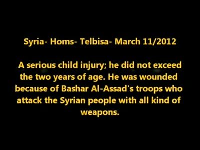 Poor Little Arab Kid Cries with Horrific Arm Injury