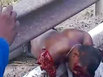 SPECIAL UPDATE: AGONY: Man with Arm Ripped Clean off is in a Complete State of Shock