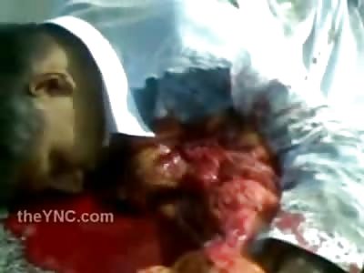 NEW: Mans Heart Beating Next to Him After Accident