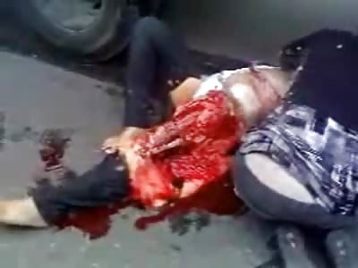 Pretty Asian Woman's Leg Ripped to Shreds after Terrible Accident