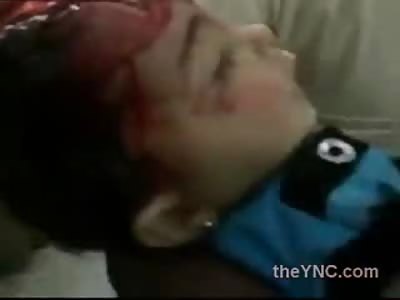 Very Sad Little Boys Brains Exposed after Brutally being Shot