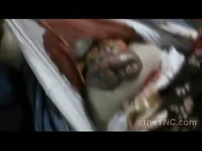 Woman laying Calm on Table with her Guts Hanging OUt