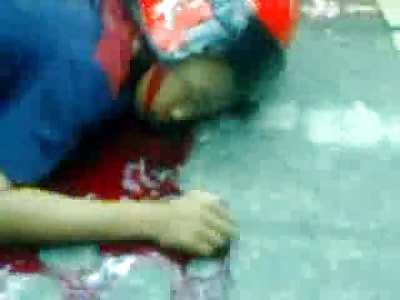 Girlfriends Head Falls apart as shes Lifted of her Dead Boyfriend