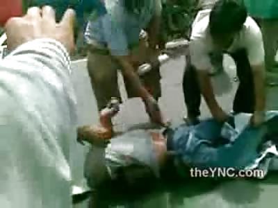 Man Twisted and Contorted Intestines Spewed on Street