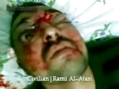 Man with Fatal Head Shot Groaning till Death in the Hosptial