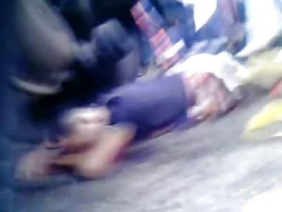 Man Cut in Half under Truck still Conscious and Alive