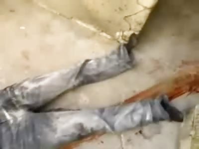 Head Shot....Man with Eye Blown out takes his Last Breath