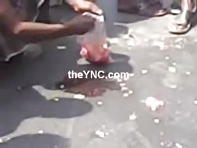 Dad in Shock picks up the Brains of his 7 Year Old Daughter after her Fatal Accident