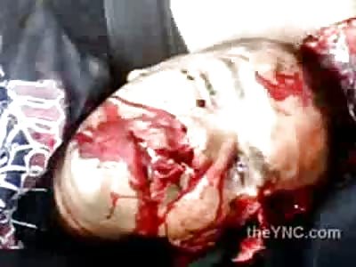 Motorcycle Accident Leaves Dead Man Staring in the Sky