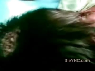 Having a Bad Day.......Try Having a Head Full of Maggots