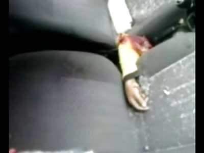 There it Is!! Arm in the Front Seat, Owner of the Arm still Alive on the Street