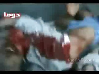 Man with His Eye Shot out Begs for Life