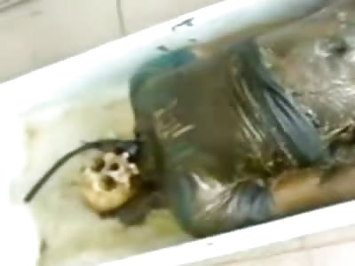 Good looking Fella now resembles Beetlejuice...