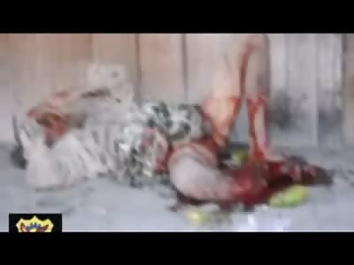 Man Pants Blown Off Mutilated after Bombing in Thailand