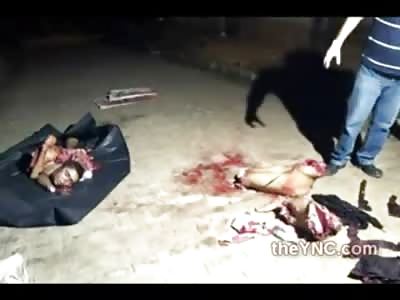 Being the Guy that has To Pick up all the Body Parts...SUCKS!!