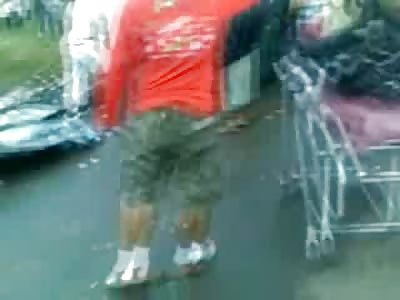 Legs Ripped Off and burned to Death Victim is Removed from Fatal Accident Scene