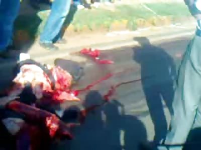 I've Seen Mutilated Bodies From Accidents But then There's This