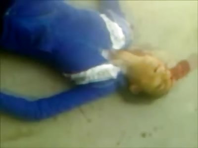 Once Beautiful Teen Girl Shot in Head..Huge Hole Remains