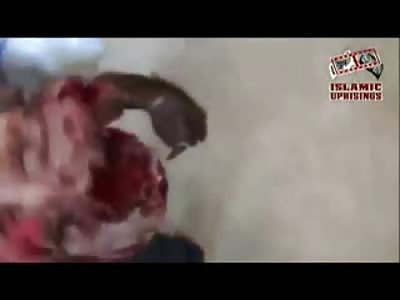 Brother and Sister Blown Apart, Boy has entire Head Hollowed Out