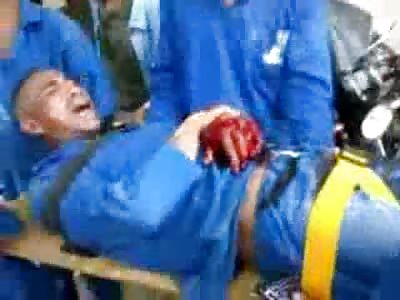 Don't Know Whats Worse his Crushed Hand or Him Crying Like a Little Bitch