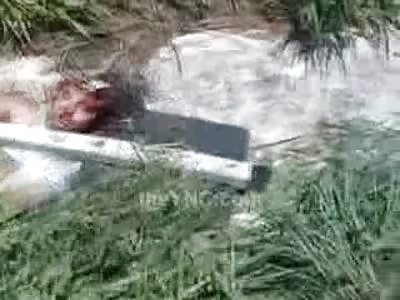 His Brain and Arm Missing after Tragic Motorcycle Accident