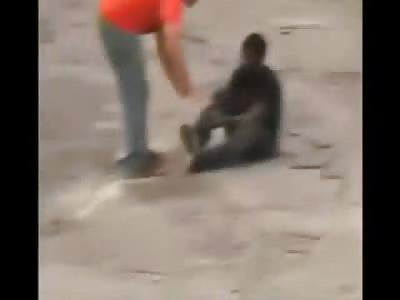 Black Boy Attempting Stupid Stunt Breaks his Leg...Screams Like a Sissy