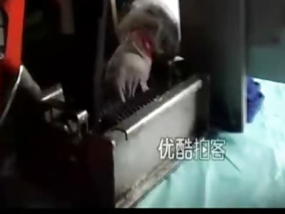 Woman in a Food service Factory Has her Fingers Ripped off her Hand in Terrible Machine Accident...Woman in Total Shock