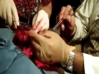 Shaking Man with Gash from Machete has Doctors working Overtime