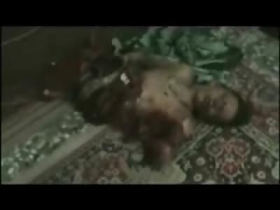 Cut in Half and Ripped Open from Bomb Attack