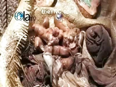 Woman Cut into Hundreds of Pieces has her Tattoos Cut out (Yes that's her Vagina) 