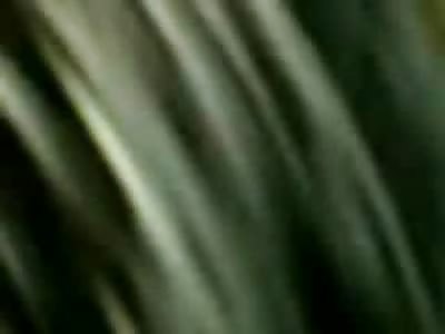 Man Choking to Death on his own Tongue and Blood after Accident