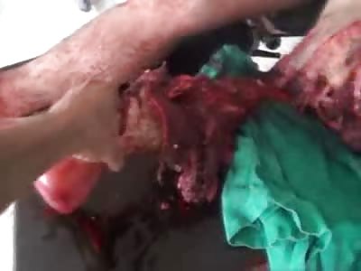 And So I was Hit by an RPG Today...