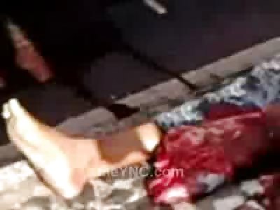 Woman's Leg Perfectly Ripped off Lies Nest to her on the Road