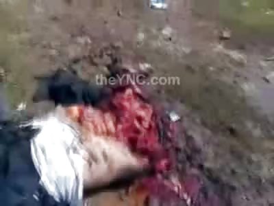 Screaming Cameraman Chronicles the Dead after Bomb Attack