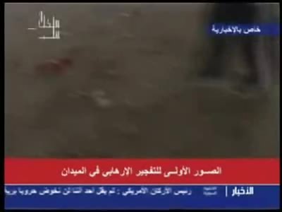 Hey Mohammed is that Abdul's Head? Ohhh Nooooooo