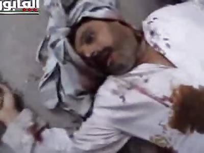 Man Shot Brains Leaking Out....Eyes Show he Stares in Fear of Death