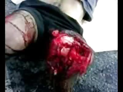 Knee EXPLOSION. Ouch 