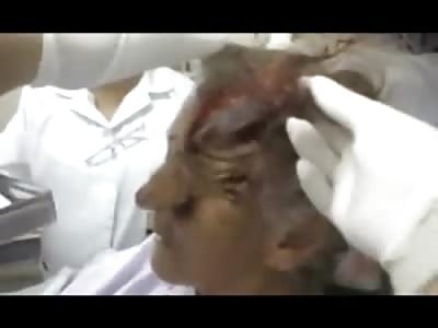 Calm Old Woman Has Half her Head Ripped off