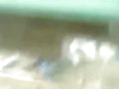 Carnage Train vs Bus Accident,  Woman with Leg Missing Still Moving