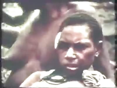 Disease Called KURU Similar to Mad Cow is a Ruthless KIller